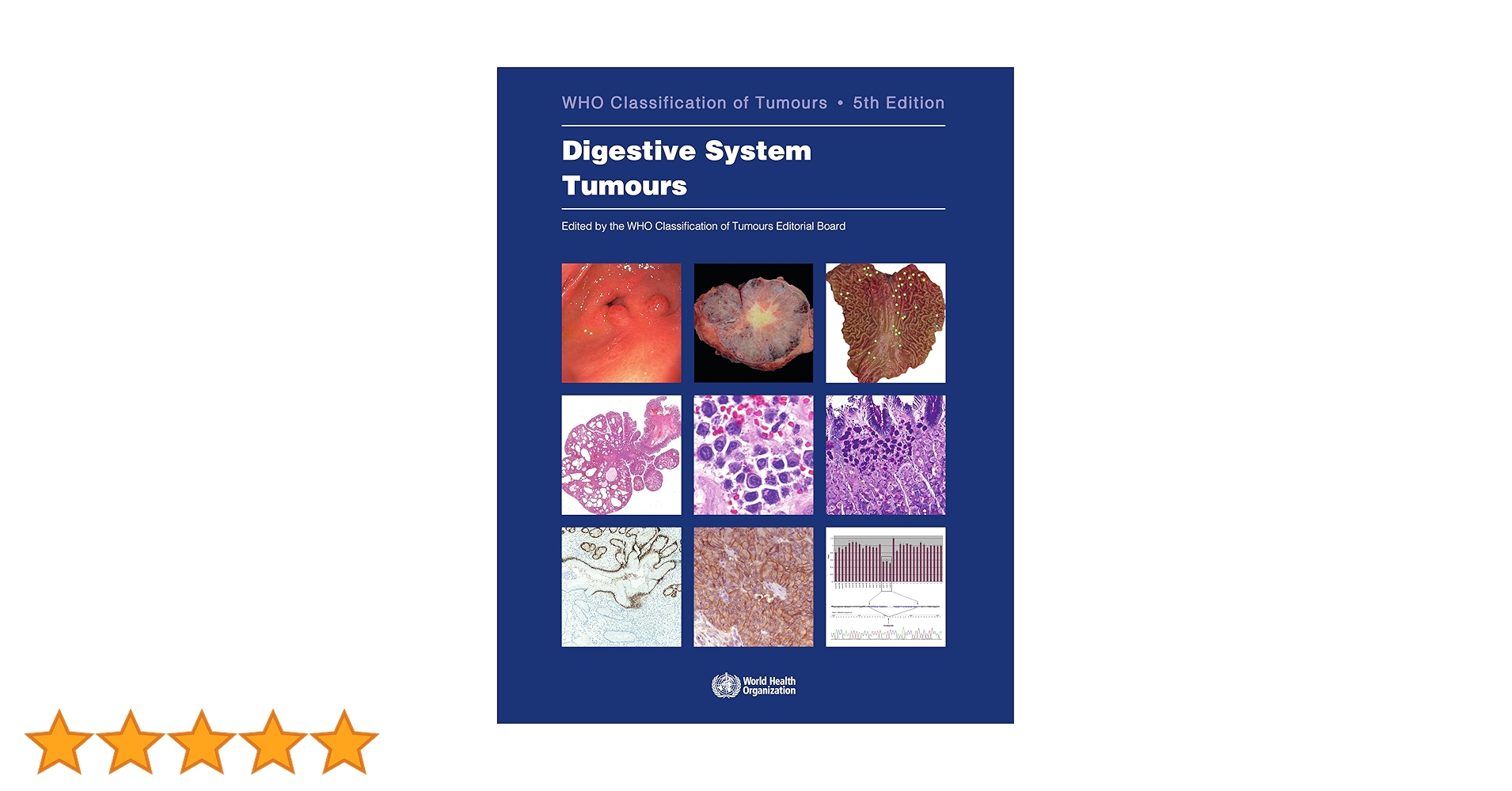 Digestive System Tumours: WHO Classification of Tumours, Volume 1